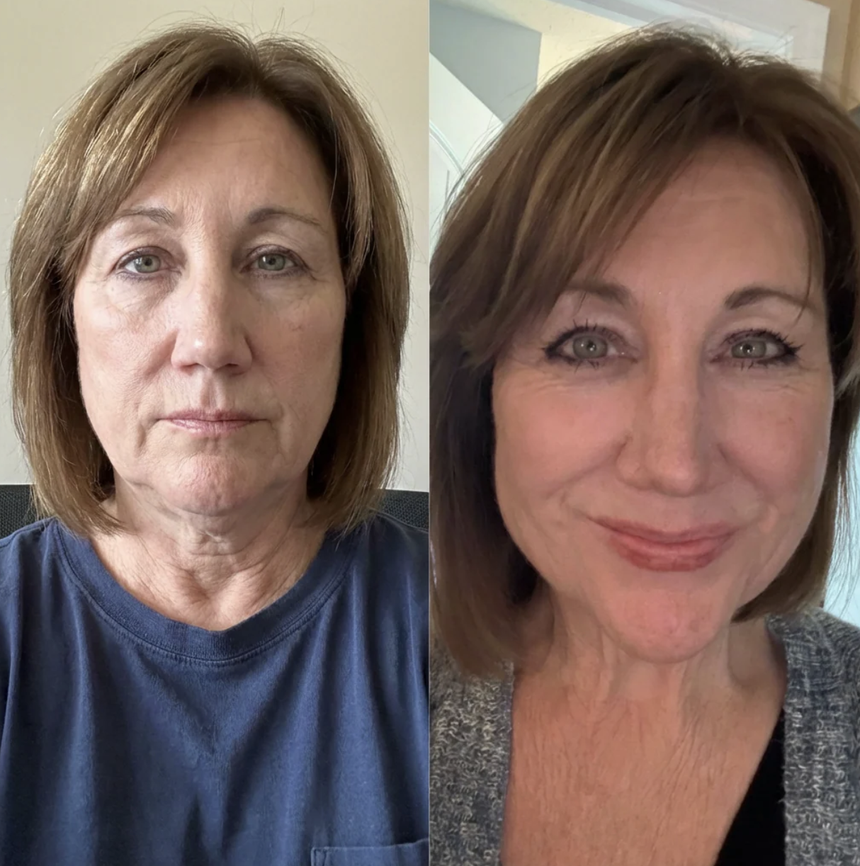 Before and after